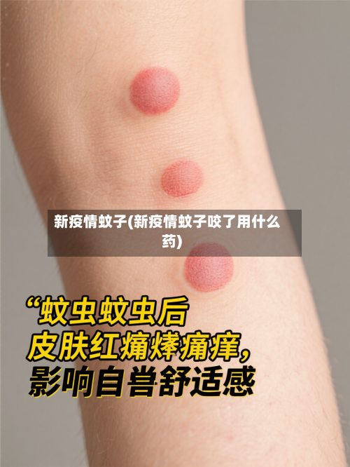 新疫情蚊子(新疫情蚊子咬了用什么药)
