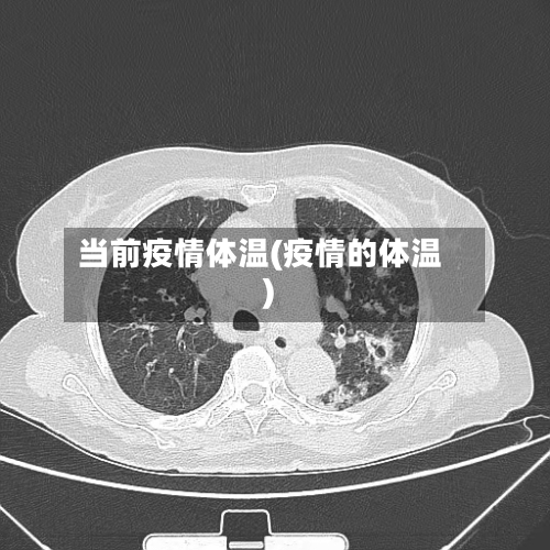 当前疫情体温(疫情的体温)