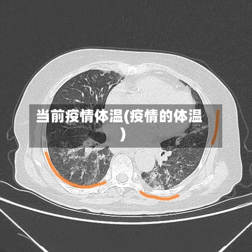 当前疫情体温(疫情的体温)-第2张图片