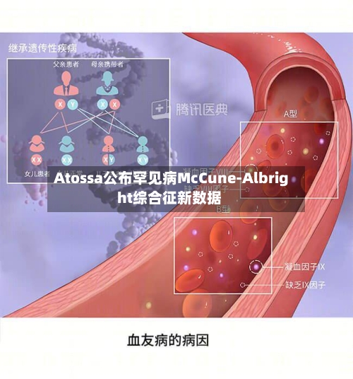 Atossa公布罕见病McCune-Albright综合征新数据-第3张图片