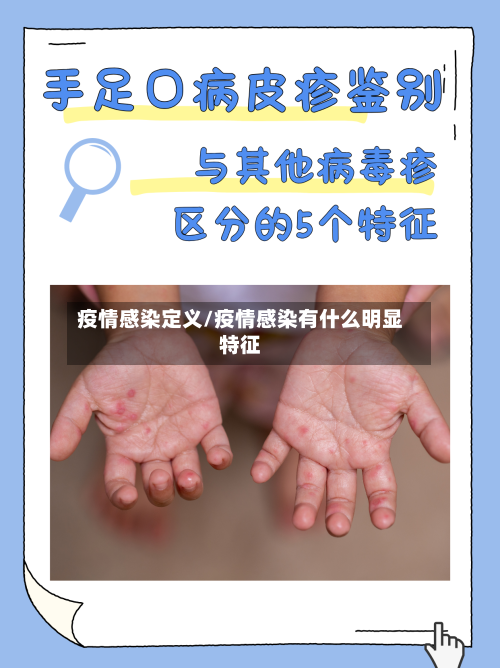疫情感染定义/疫情感染有什么明显特征-第3张图片