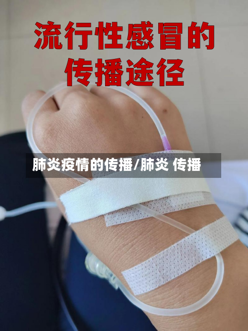肺炎疫情的传播/肺炎 传播