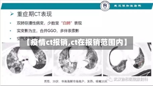 【疫情ct报销,ct在报销范围内】-第2张图片
