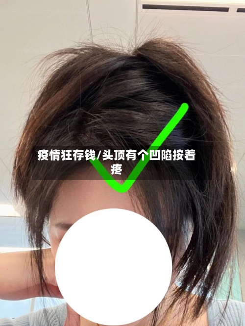疫情狂存钱/头顶有个凹陷按着疼-第3张图片