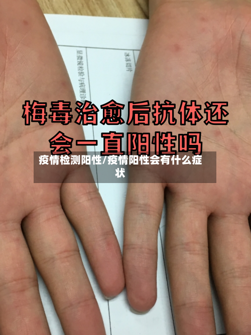 疫情检测阳性/疫情阳性会有什么症状-第3张图片