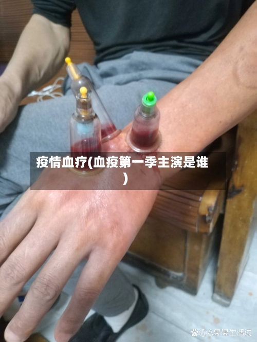 疫情血疗(血疫第一季主演是谁)-第2张图片