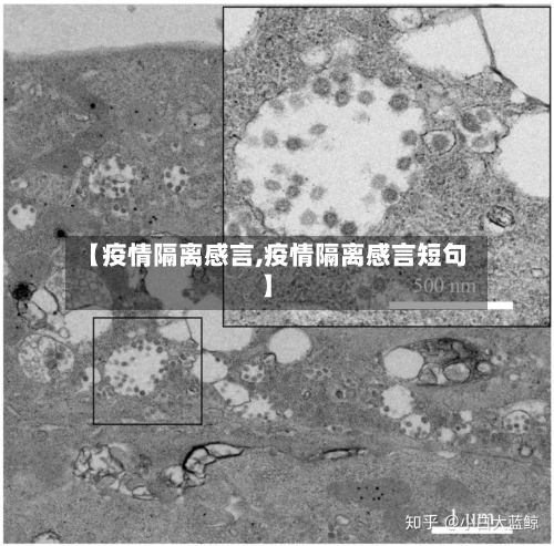 【疫情隔离感言,疫情隔离感言短句】-第3张图片