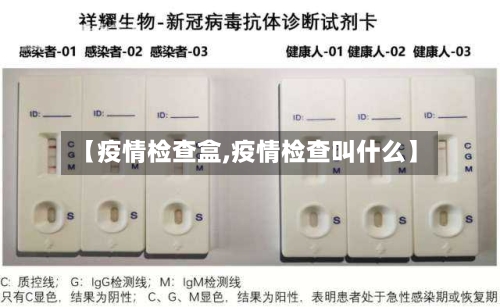 【疫情检查盒,疫情检查叫什么】