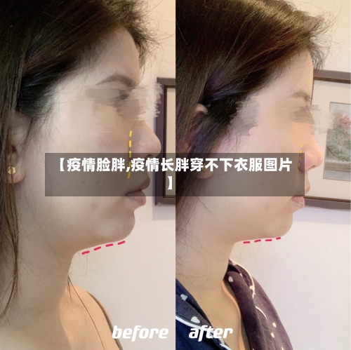 【疫情脸胖,疫情长胖穿不下衣服图片】-第1张图片