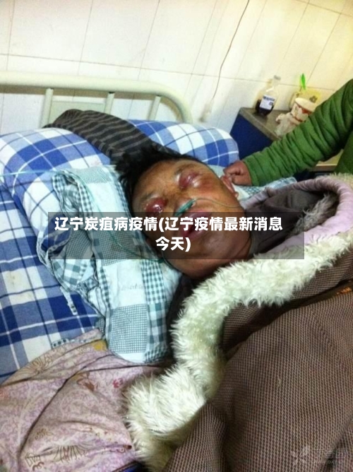 辽宁炭疽病疫情(辽宁疫情最新消息今天)-第2张图片